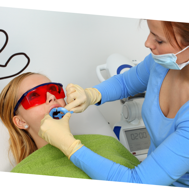 Add Teeth Whitening to your Professional Salon Salon